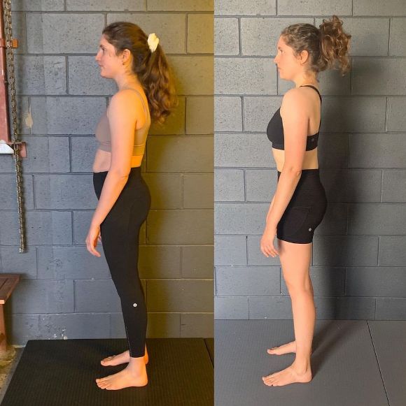 Irenie before and after posture correction