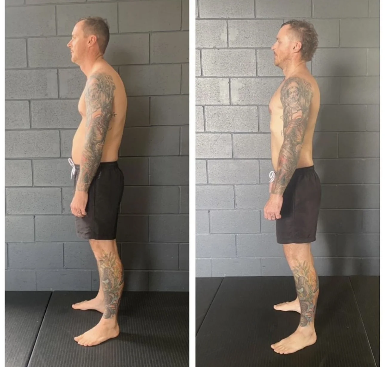 Matt 8-month posture transformation